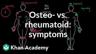 Osteoarthritis vs rheumatoid arthritis symptoms  NCLEX-RN  Khan Academy
