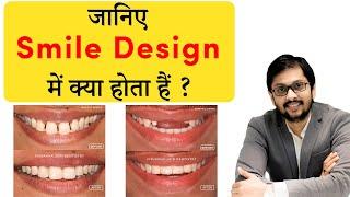 जानिए Smile Design में क्या होता हैं ?  Dr Ankit Khasgiwala  Seraphic Dental Indore