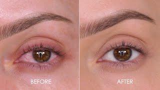 WOW - How To Remove Eye Redness In Minutes  Shonagh Scott