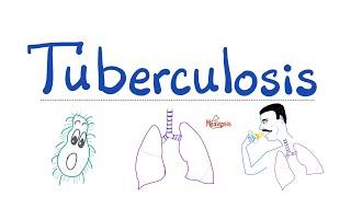 Tuberculosis TB - The Most Comprehensive Explanation - Respiratory Pathology - Pulmonology Series