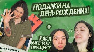 О НАБОЛЕВШЕМ  ЧТО ПОДАРИЛИ НА ДЕНЬ РОЖДЕНИЯ? КАК Я ВЫЛЕЧИЛА ПРЫЩИ