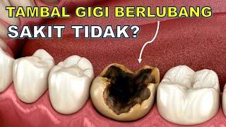 Tambal gigi berlubang sakit tidak