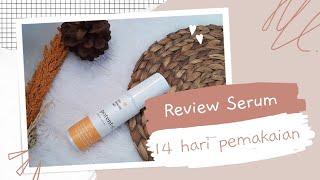 Serum untuk Bekas Jerawat & Flek Hitam