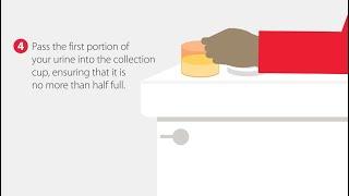 How to Collect a Urine Sample  Step-by-Step Guide