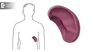 What causes a spleen to enlarge? Can you a shrink an enlarged spleen? - Dr. Lorance Peter