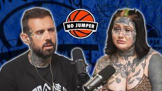 Orylan on Nitrous Addiction Losing Use of Her Legs Weight Gain Getting Pregnant & More