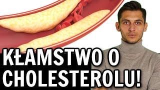 Cholesterol całkowity LDL HDL - normy to kłamstwoNowe i prawidłowe normy cholesterolu Szemraj