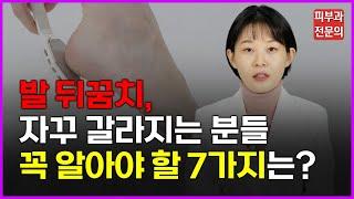 돈 안 들고 발 각질 싹 제거하는 방법 7가지? -발뒤꿈치 갈라짐 각질제거방법