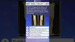 NEET MDS  INI-CET MDS  PSC  BDS - Most Important Questions  #neetmds2025 #mdsprep