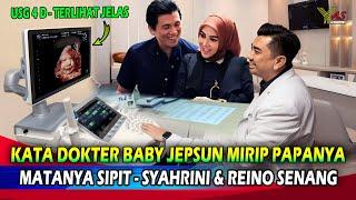 USG 4D  AKHIRNYA SYAHRINI & REINO BARACK LIHAT LANGSUNG WAJAH CALON BABY JEPSUN