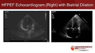 Management of Pulmonary Arterial Hypertension in Primary Care Advancing Patient Outcomes