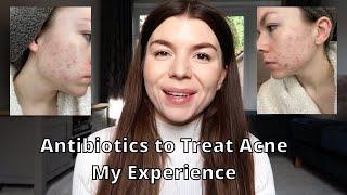 My Experience on Antibiotics for Acne erythromycin and doxycycline Did They Work? My Acne Journey