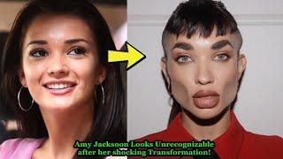 Amy Jackson Looks Unrecognizable after her shocking Plastic Surgery fillers and Botox