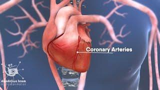 Coronary Angioplasty 3d medical animation  by Dandelion Team