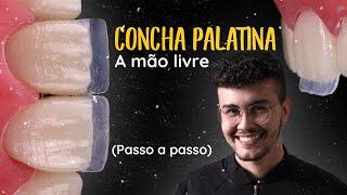 Tutorial de Como Fazer a Concha Palatina a Mão Livre para suas Facetas em Resina Composta