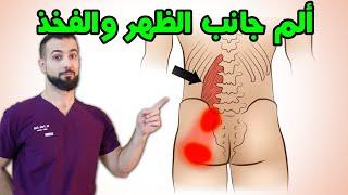 علاج ألم أسفل الظهر والفخذ من جانب واحد  العضلات القطنية العميقة