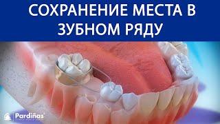 Молочные зубы и сохранение места в зубном ряду ©