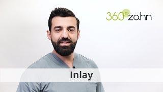 Inlay - Was ist ein Inlay?  Dental-Lexikon  360°zahn