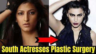 SHOCKING Plastic Surgery of South Indian Actresses BEFORE & AFTER  Samantha Akkineni Rashmika