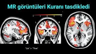 Yalan anında çekilen bu MR filmleri Kuranı resmen ispat etmiş