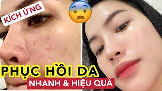 CÁCH PHỤC HỒI DA KÍCH ỨNG GIÁ RẺ  NHANH VÀ HIỆU QUẢ CHỈ TRONG 3 NGÀY