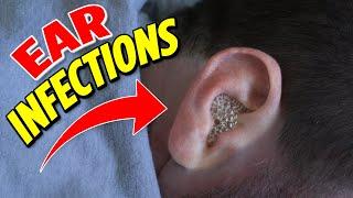 Ear infections the 2 main types