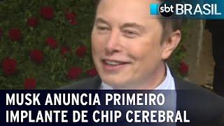 Musk anuncia primeiro implante de chip cerebral em humanos  SBT Brasil 300124