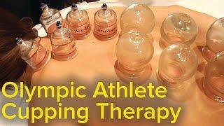 Chinese Cupping Therapy - Michael Phelps Olympics Bruise Mystery Solved  Pain Relief and Therapy