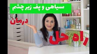 سیاهی زیر چشمدرمان سیاهی و پف زیر چشم