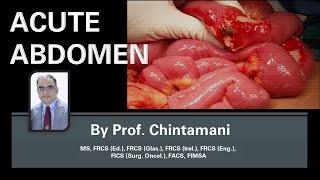 Acute Abdomen - Etiopathogenesis Diagnosis and Management by Prof. Chintamani