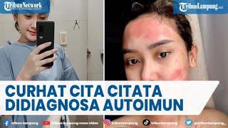 Curhat Cita Citata Didiagnosa Penyakit Autoimun  @TRIBUNLAMPUNGNEWSVIDEO