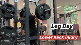 Leg DayFeaturing Lower Back Injury