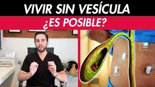 ¿Te van a operar de la vesícula? Te explico cómo es después