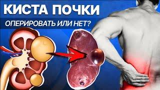 Киста почки как лечить? Операция нужна не всем и не всегда