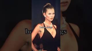 Before Drugs & After #Katemoss #model #catwalk #shortfeed #supermodel #celebrities