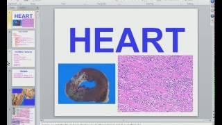 Medical School Pathology 2012 Session 041 Heart I.mp4