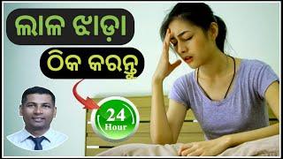 Dysentery Home Remedies  How to Stop Dysentery at natural process  Lala jhada gharoi upachara 