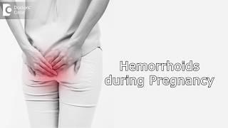 How to manage Hemorrhoids during Pregnancy?  - Dr. Rashmi Chaudhary