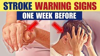 10 STROKE Warning Signs ONE WEEK Before It Happens