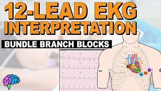 Bundle Branch Blocks MADE EASY - 12 Lead EKG