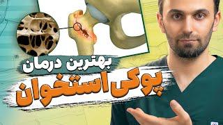 درمان پوکی استخوان و پیشگیری از آن  Osteoporosis prevention and treatment