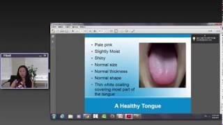 Traditional Chinese Medicine Webinar Tongue Diagnosis