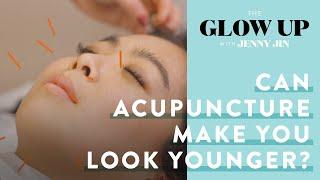 Can Facial Acupuncture Make You Look Younger?  The Glow Up