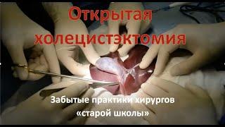 Открытая холецистэктомия техника операции