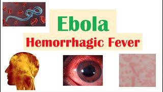 Overview of Ebola  Hemorrhagic Fever Causes Pathophysiology Symptoms Diagnosis Treatment