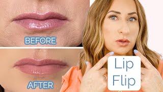 LIP FLIP- Can you Tell?? BEFORE and AFTER {Botox Over 40}