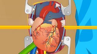 OPERATE NOW  HEART SURGERY  PLAY SURGERY GAMES