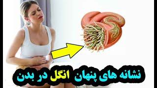 نشانه های وجود انگل در بدن