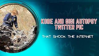 kobe and gigi autopsy twitter Pic  Kobe and Gigi Autopsy twitter Pic and de**d pictures  zeke