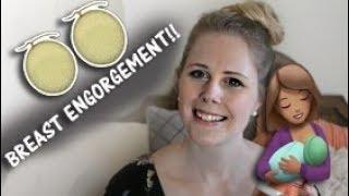 BREAST ENGORGEMENT + Clogged ducts RELIEF  Mama Chats